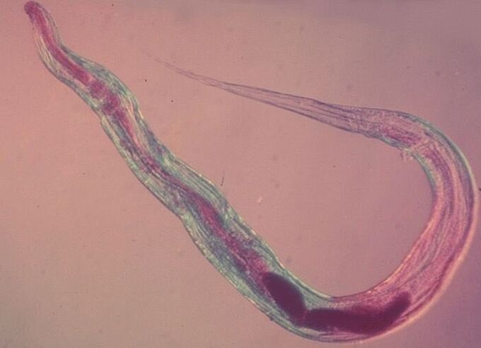 Pinworm pod mikroskopem