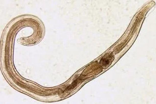paraziti člověka threadworm